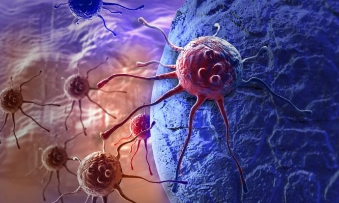 Καρκίνος του παχέος εντέρου – Συμπτώματα: 1 στους 4 τα μπερδεύει με αυτό! – [vid]